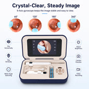 Sofbunny A03 visual ear cleaner with stable built-in screen view