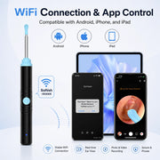 Sofbunny S2 visual ear cleaner with Wi-Fi app control for Android, iPhone and iPad